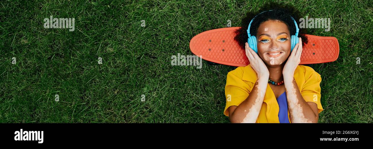 Multiethnische Frau mit Vitiligo trägt blaue Kopfhörer und hört Musik, die auf einem Rasen in der Nähe des Skateboards liegt und ein glückliches Gesicht hat. Grünes Gras mit leerem Raum Stockfoto