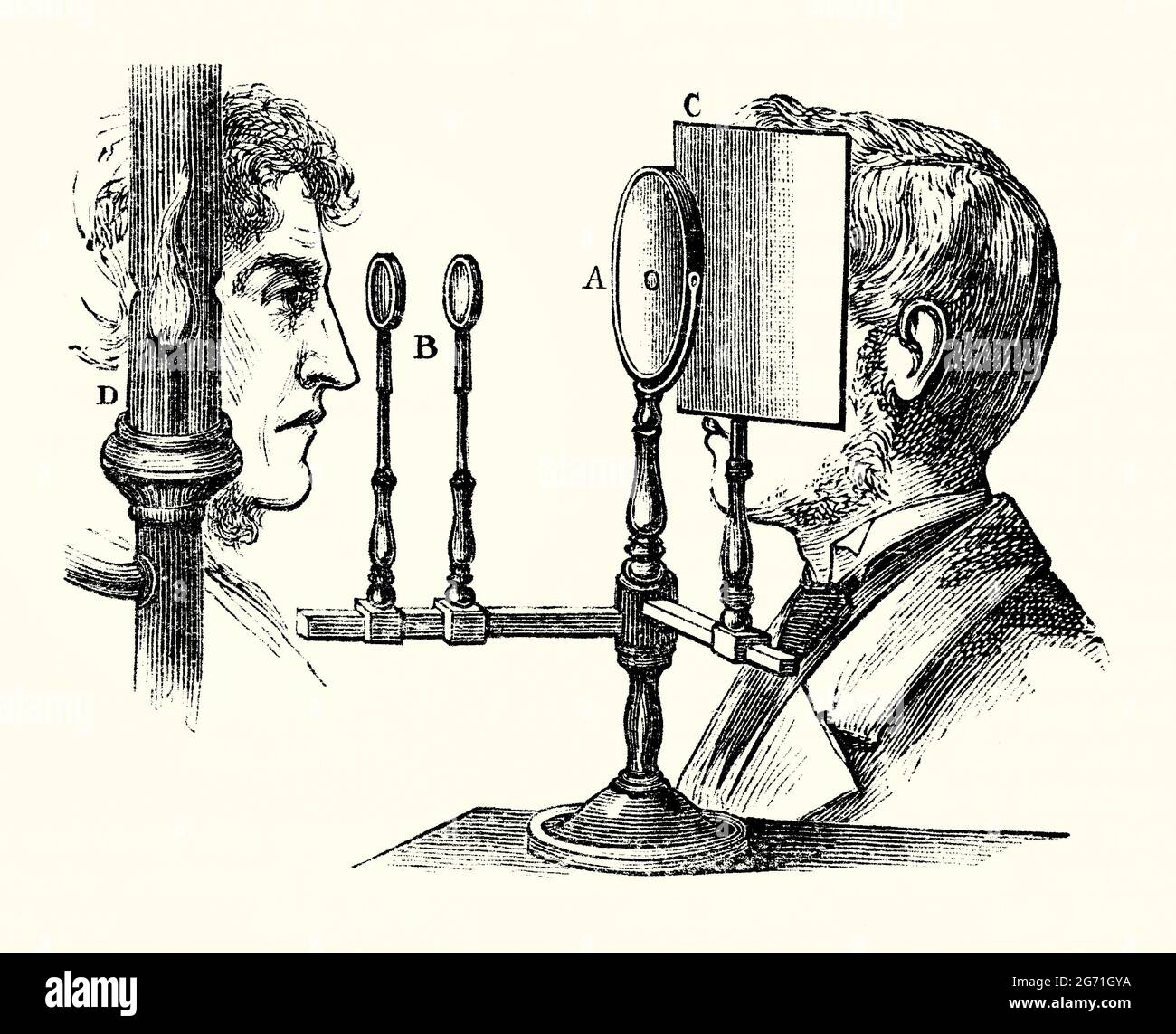 Ein alter Stich eines Ruete-Ophthalmoskops um 1850. Es stammt aus einem Buch der 1890er Jahre über viktorianische Entdeckungen und Erfindungen im 19. Jahrhundert. Die Ophthalmoskopie ermöglicht einen Blick in den Augeninnenraum mit einem Ophthalmoskop (Funduskop). Christian Ruete hat bestehende Geräte modifiziert. Seine ‘indirekte Ophthalmoskopie’ hat mit einem konkaven Fokussierspiegel einen besseren Blick auf den Fundus gegeben. Ein Ständer hält den Spiegel (A). Es hat eine kleine Blende, um mit zwei Fokussierobjektiven (B) in ein Auge zu sehen. Lampe (D) ist die einzige Lichtquelle in einem dunklen Raum. Bildschirm (C) schützt den Betrachter vor unerwünschten Strahlen. Stockfoto