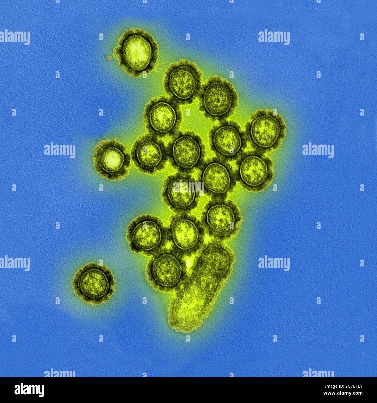 Diese digital kolorierte, mikroskopische Transmissionselektronenaufnahme (TEM) des US National Institute of Allergy and Infectious Diseases (NIAID) zeigt eine Anzahl von H1N1-Influenza-Viruspartikeln. Oberflächenproteine, die sich auf der Oberfläche der Viruspartikel befinden, sind schwarz dargestellt. Eine optimierte und verbesserte Version eines Bildes, das vom US National Institute of Allergy and Infectious Diseases produziert wurde / Kredit: NIAID Stockfoto