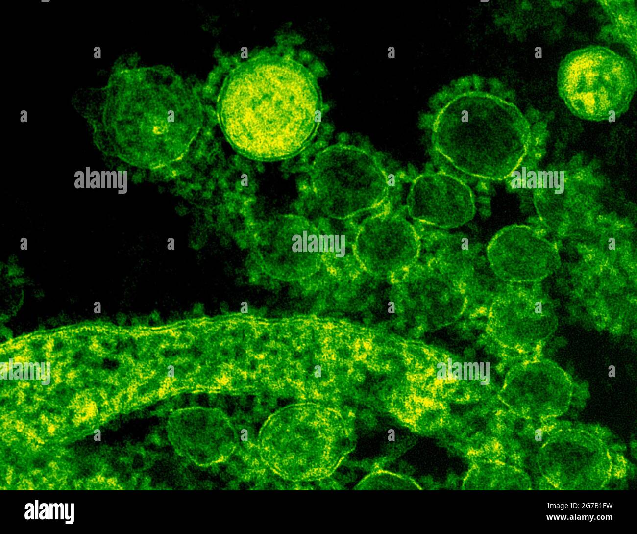 Dieses vom US National Institute of Allergy and Infectious Diseases (NIAID) produzierte, hoch vergrößerte, digital kolorierte Transmissionselektronenmikroskopische (TEM)-Bild zeigt ultrastrukturelle Details, die von einer Reihe sphärischer Coronavirus-Virionen (MERS-CoV) des Middle East Respiratory Syndrome gezeigt werden. Eine optimierte und verbesserte Version eines Bildes, das vom US National Institute of Allergy and Infectious Diseases produziert wurde / Kredit: NIAID Stockfoto