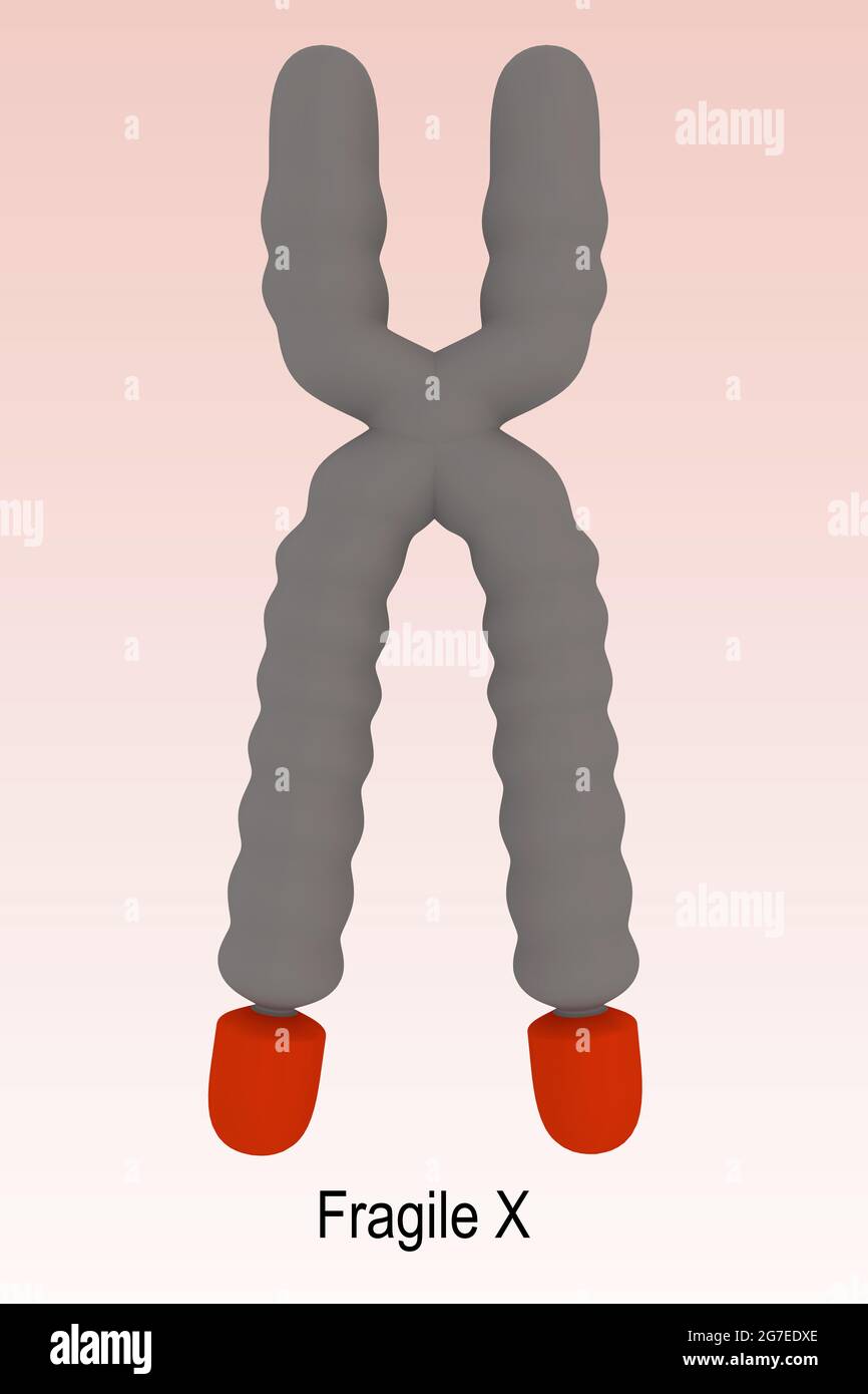 3D-Darstellung eines Chromosoms mit fragiler X-Schrift, isoliert auf rotem Gradient. Stockfoto