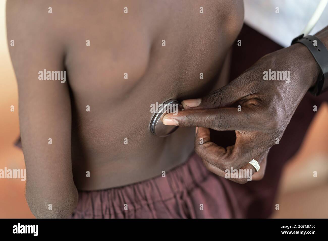Nahaufnahme eines afrikanischen schwarzen Arztes, der dem afrikanischen Kind mit Atemproblemen hilft. Stockfoto