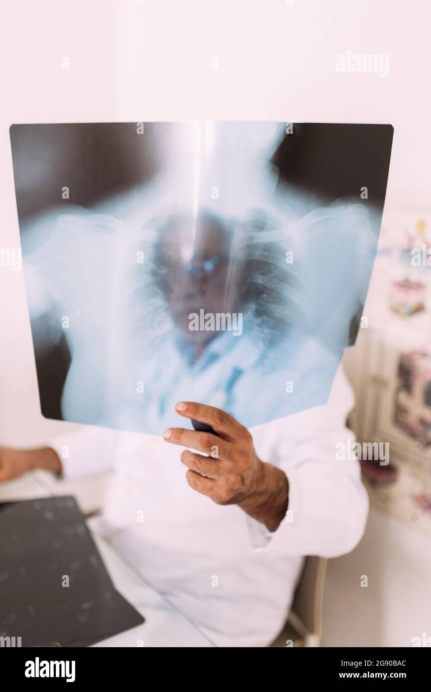 Leitender Arzt, der Röntgenaufnahmen im Krankenhaus untersucht Stockfoto
