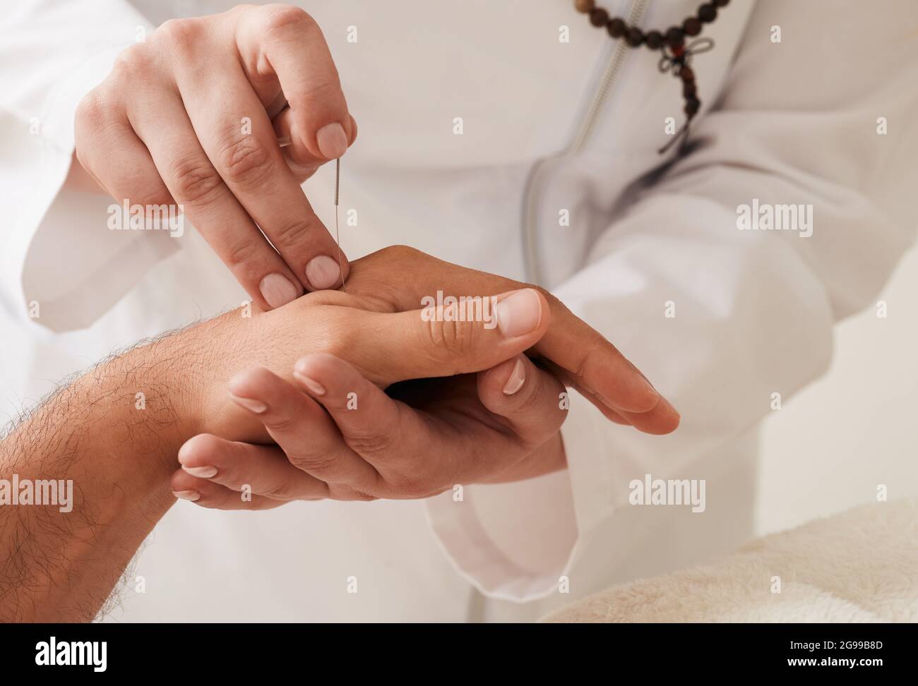 Der Reflexologe führt die Akupunkturnadel in die Handgelenkshand des Patienten ein. Akupunkturbehandlung, Reflexzonenmassage, alternative Medizin Stockfoto