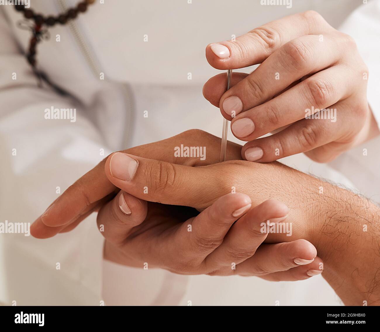 Nahaufnahme des Einfügens der Akupunkturnadel in die Handgelenk des Patienten. Akupunkturbehandlung, Reflexzonenmassage, alternative Medizin Stockfoto