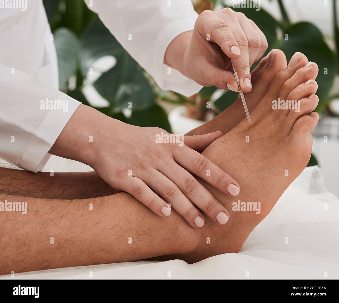 Akupunkturbehandlung bei chronischen Fußschmerzen. Chiropraktiker macht Akupunkturtherapie für Patientenfüße mit Nadeln. Reflexzonenmassage Stockfoto