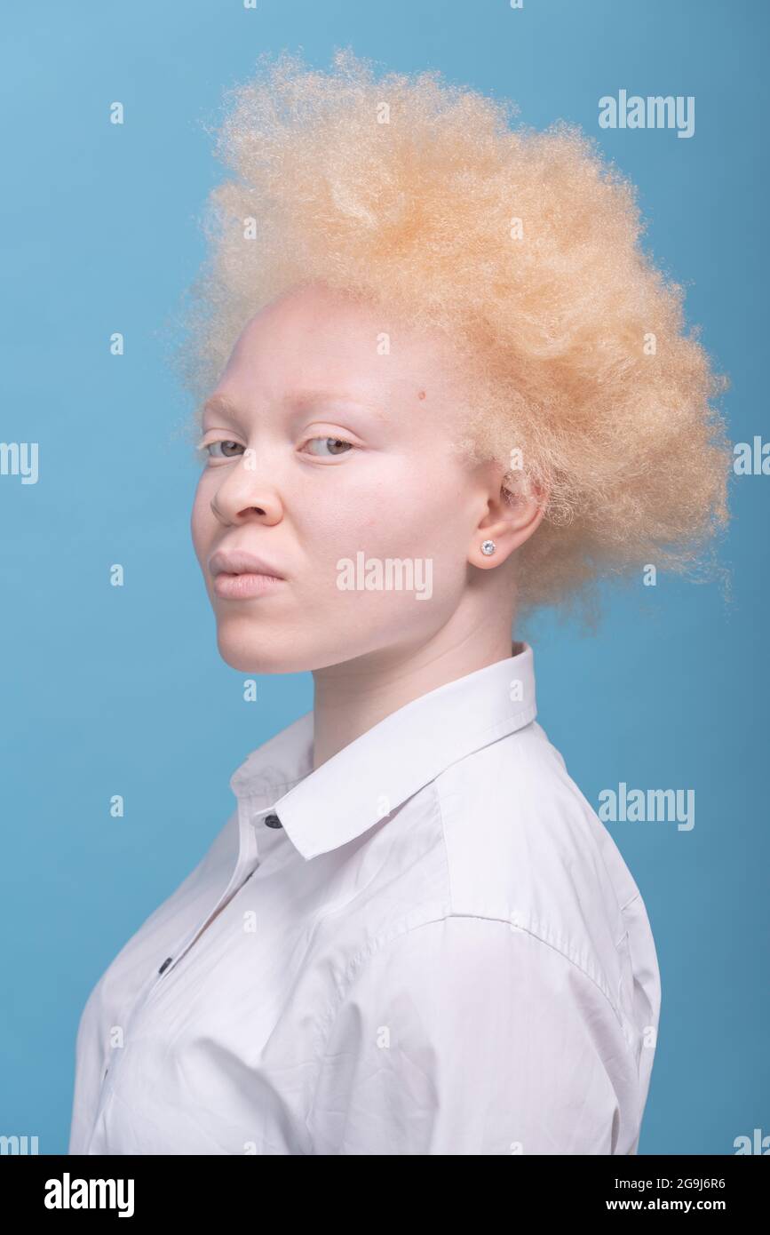 Studio-Porträt einer Albino-Frau in weißem Hemd Stockfoto