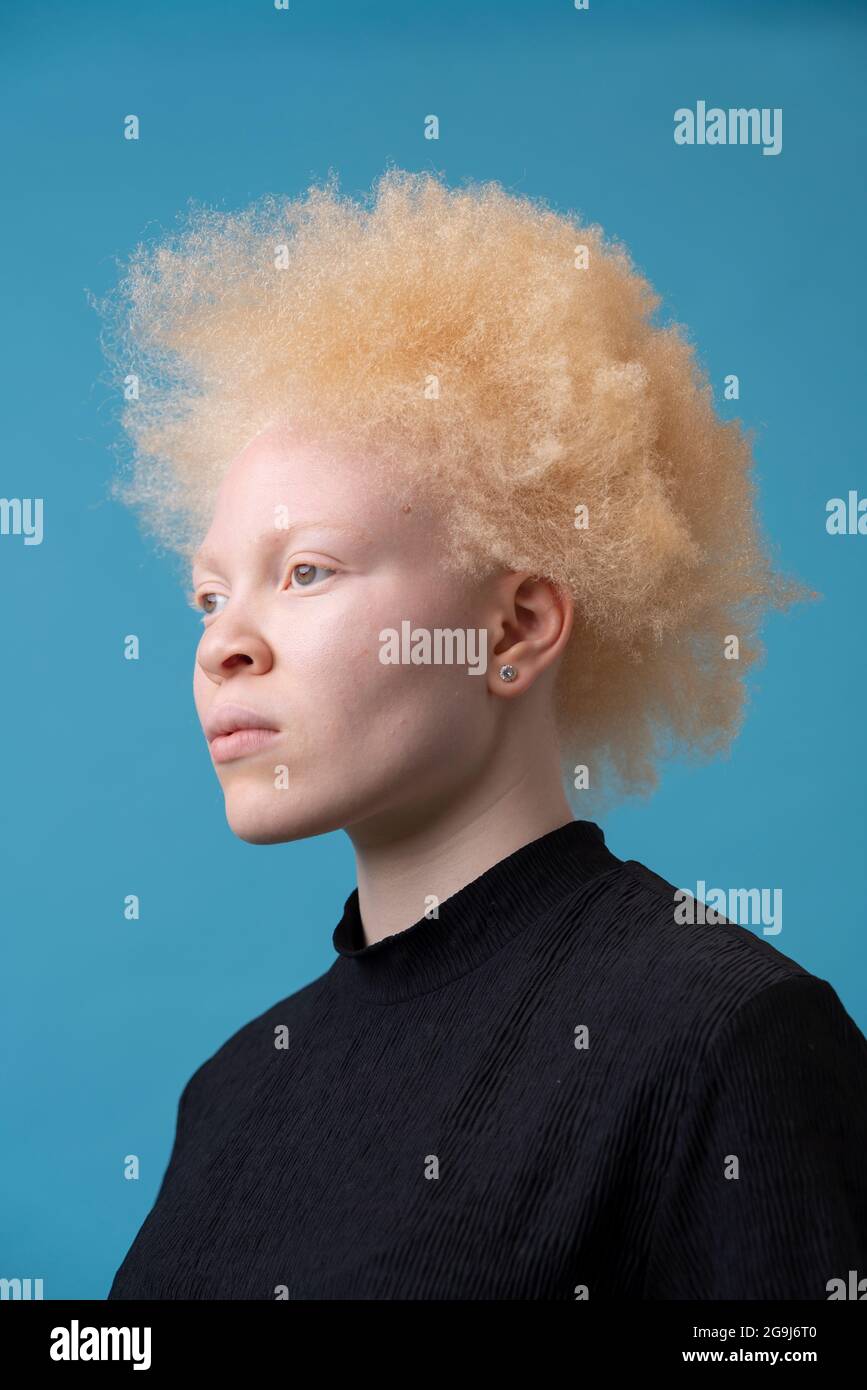 Studioportrait der Albino-Frau Stockfoto