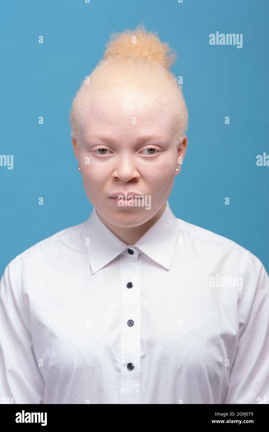 Studio-Porträt einer Albino-Frau in weißem Hemd Stockfoto