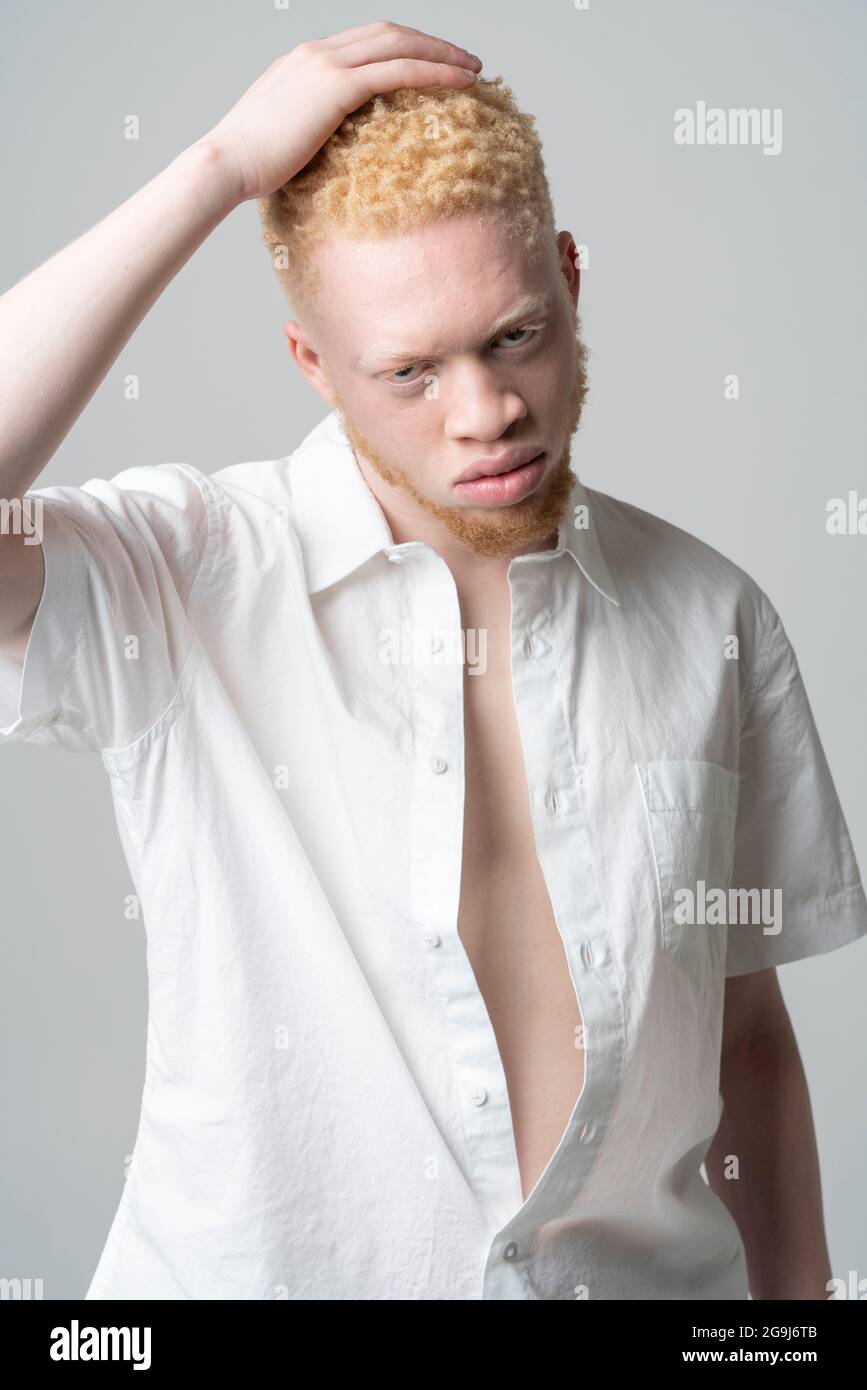 Studio-Portrait des Albino-Mannes in weißem Hemd Stockfoto