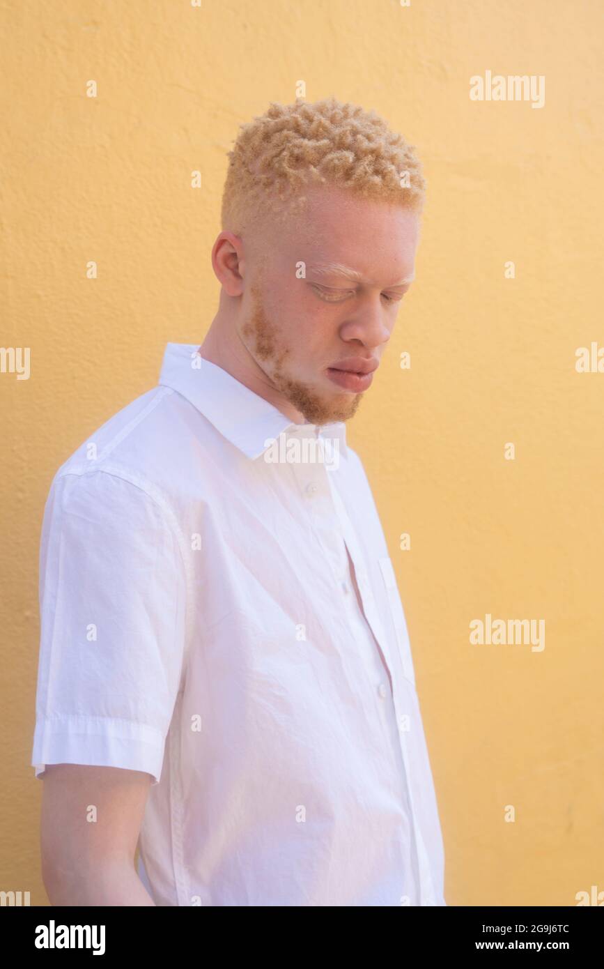 Deutschland, Köln, Albino Mann in weißem Hemd an gelber Wand Stockfoto