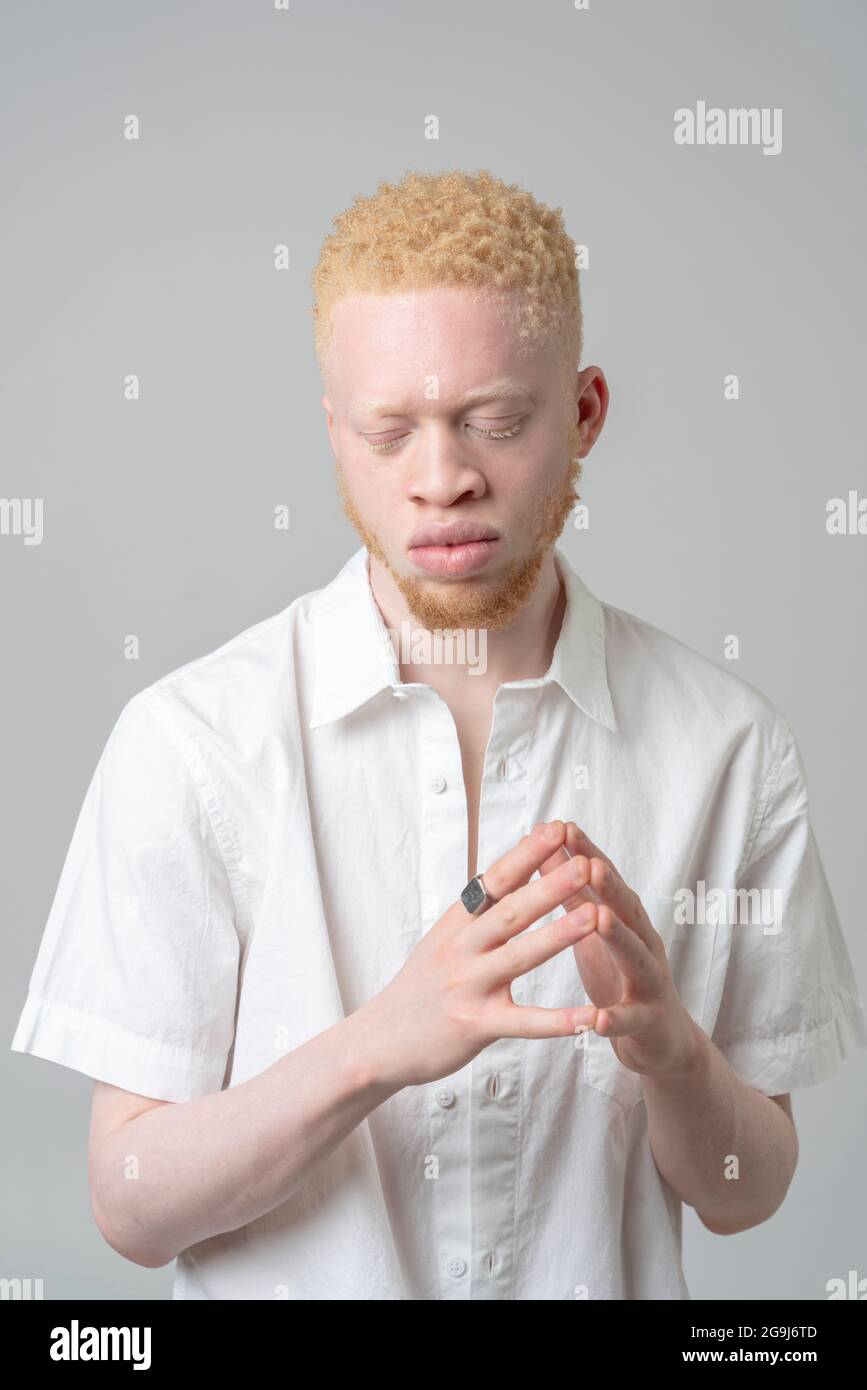 Studio-Portrait des Albino-Mannes in weißem Hemd mit geschlossenen Augen Stockfoto