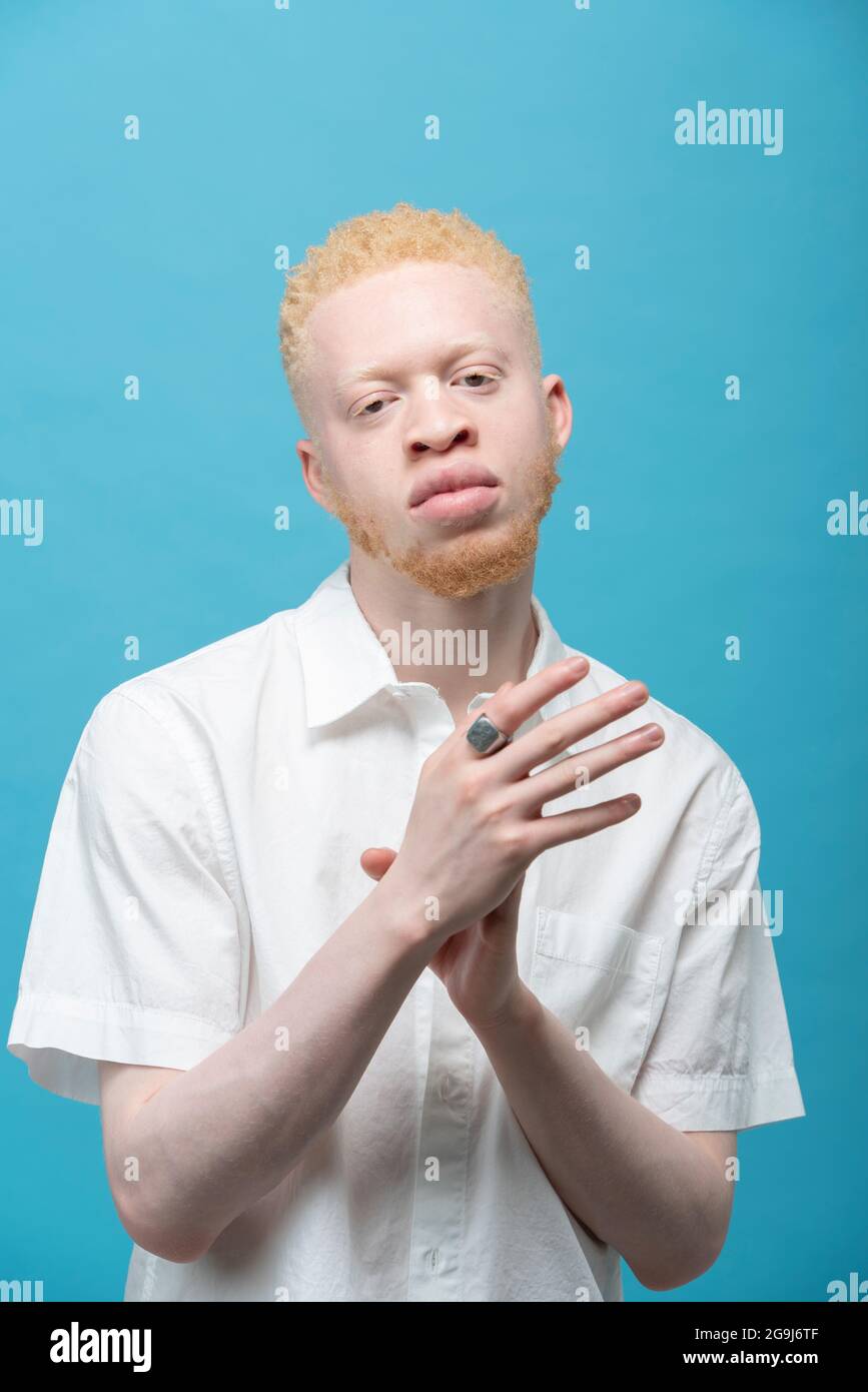 Studio-Portrait des Albino-Mannes in weißem Hemd Stockfoto