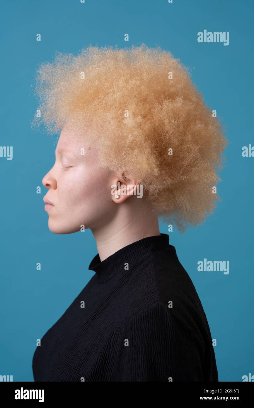 Studio-Porträt einer Albino-Frau mit geschlossenen Augen Stockfoto