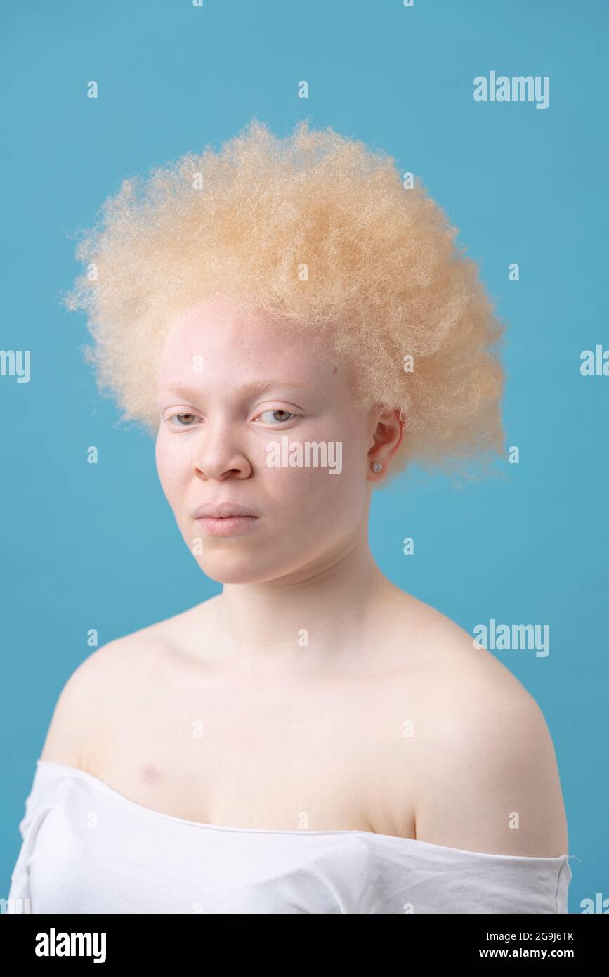 Studioportrait der Albino-Frau Stockfoto