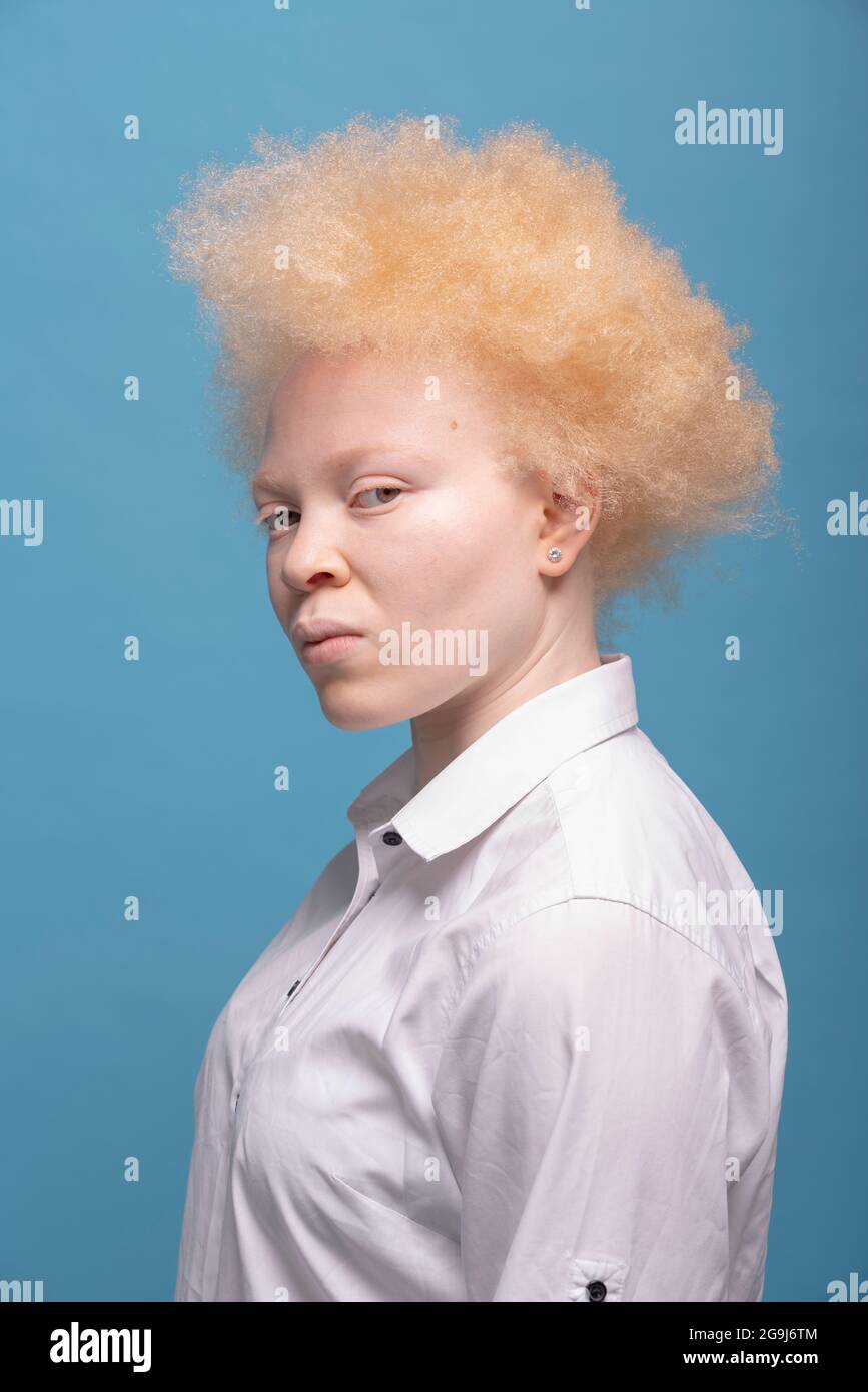 Studio-Porträt einer Albino-Frau in weißem Hemd Stockfoto