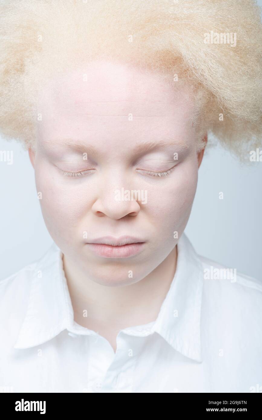 Nahaufnahme einer Albino-Frau mit geschlossenen Augen Stockfoto