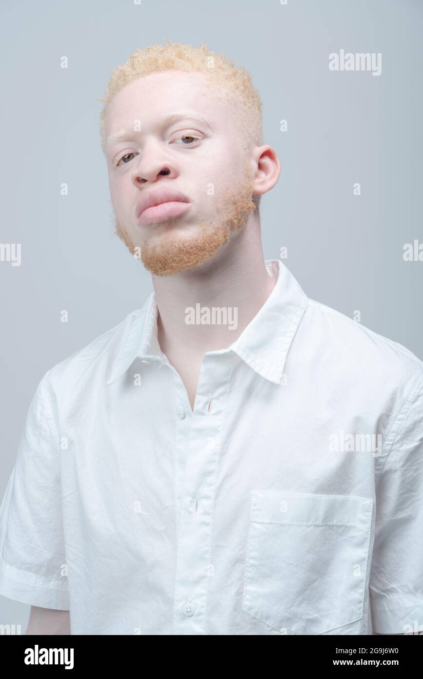 Studio-Portrait des Albino-Mannes in weißem Hemd Stockfoto