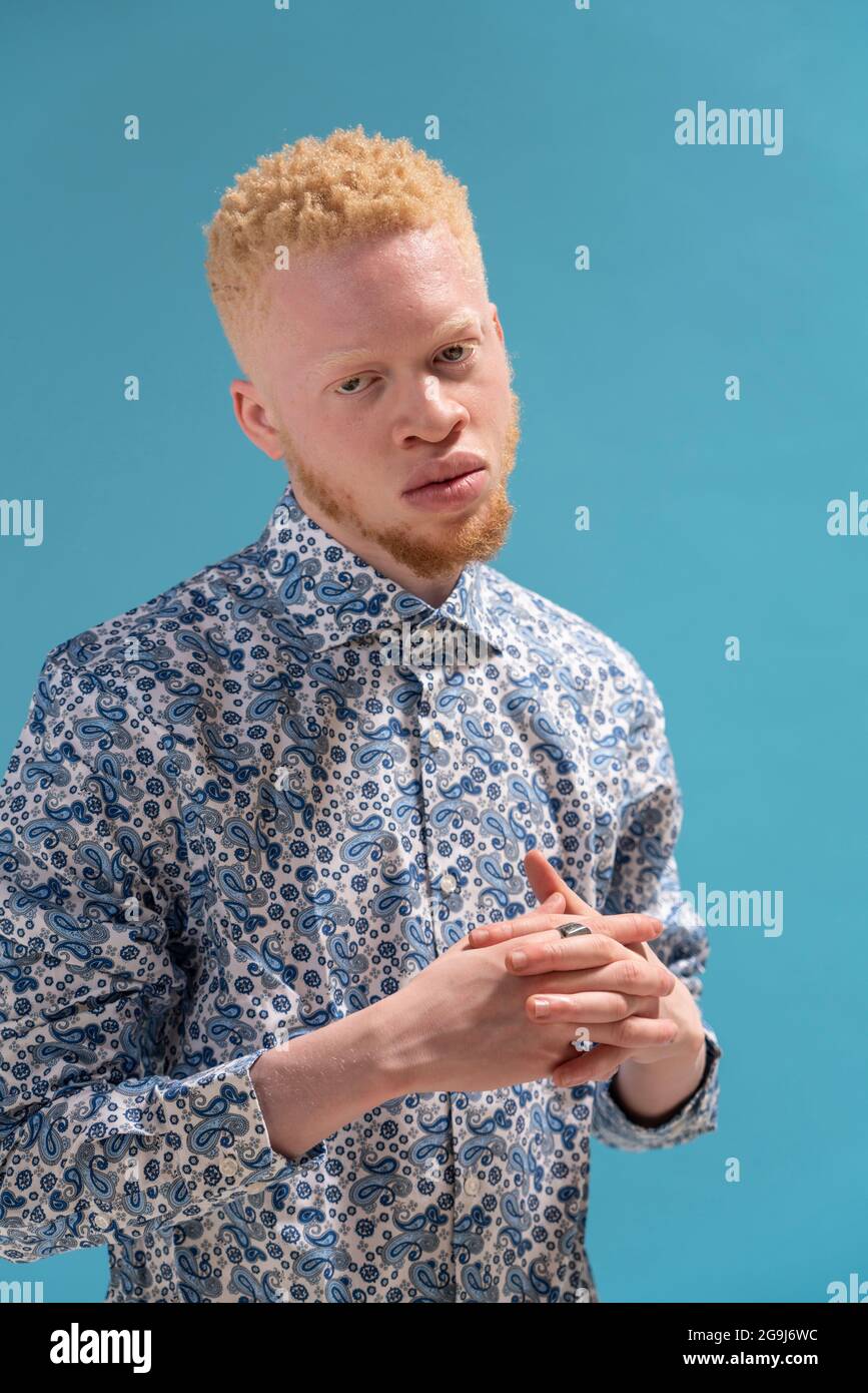 Studio-Porträt des Albino-Mannes in blau gemustertem Hemd Stockfoto
