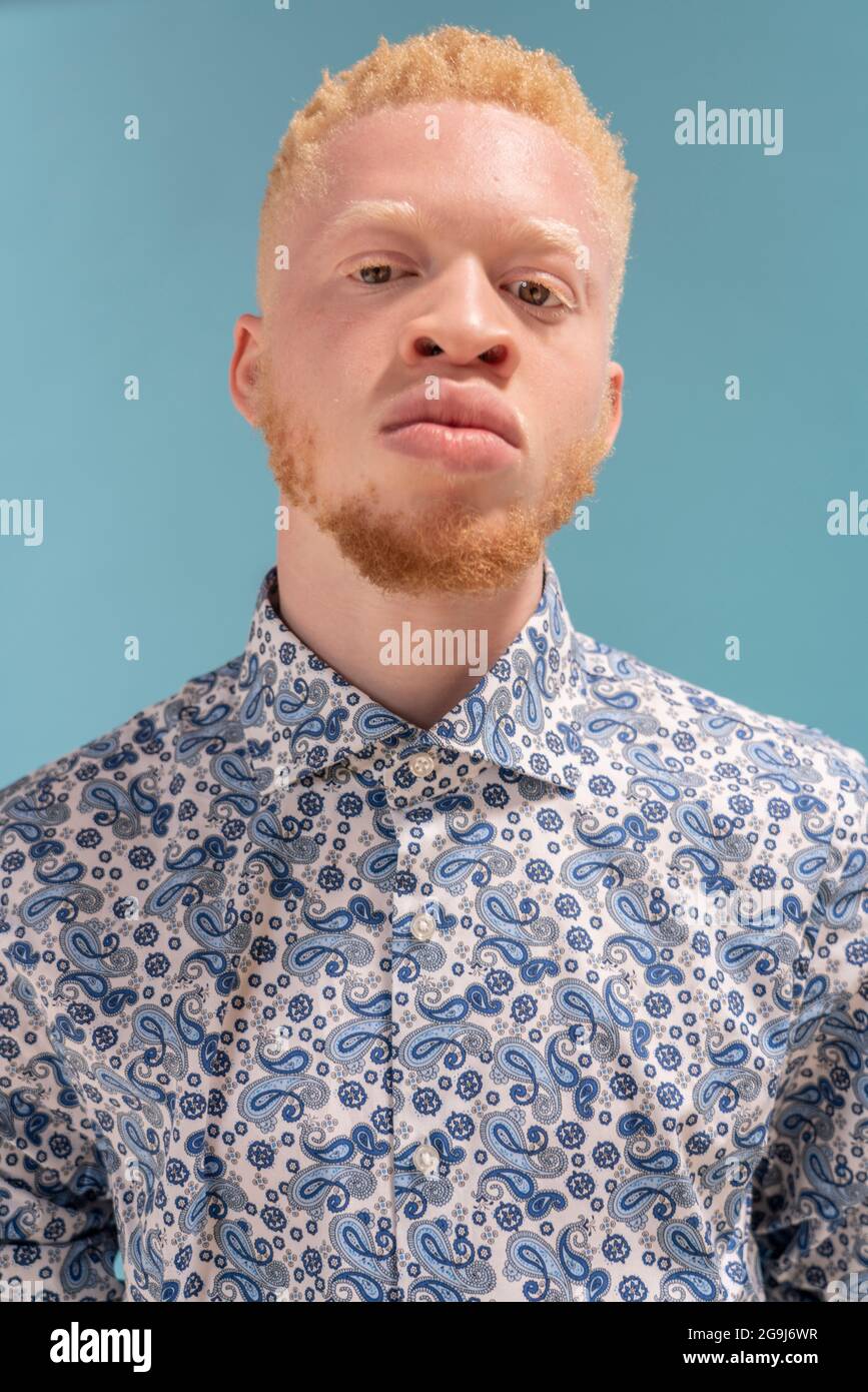 Studio-Porträt des Albino-Mannes in blau gemustertem Hemd Stockfoto