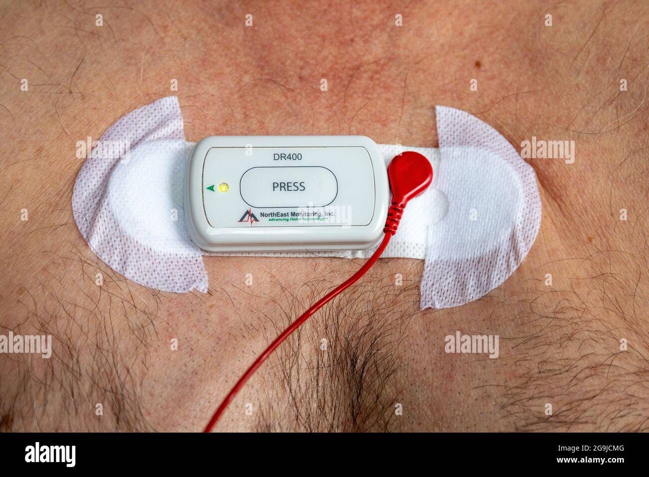 Der Holter-Herzmonitor an DER Brust eines männlichen kaukasischen Patienten zur Aufzeichnung der elektrischen Aktivität des Herzens für bis zu 72 Stunden misst Ihre Herzfrequenz. Stockfoto