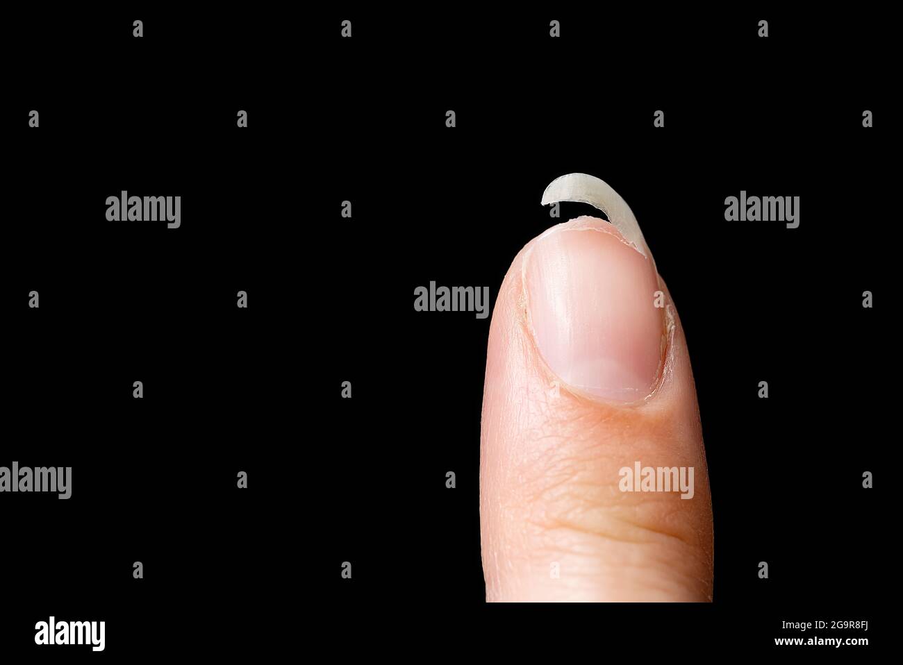Gebrochener fingernagel -Fotos und -Bildmaterial in hoher Auflösung – Alamy