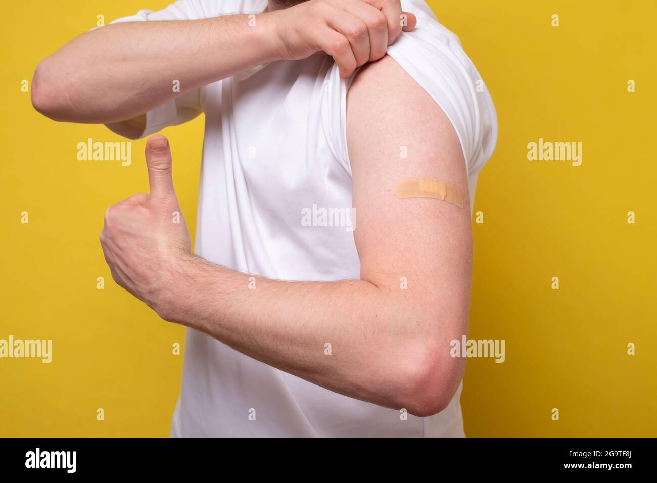 Junger Mann, nachdem er sie erhalten hat, erhält eine Antivirenimpfung covid-19. Arm und Daumen nach oben zeigen Stockfoto