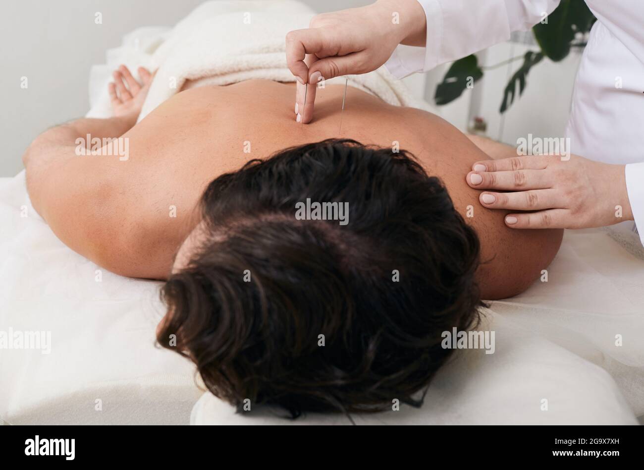 Akupunktur, traditionelle Chinesische Medizin, alternative Medizin, Reflexzonenmassage, Akupressur Stockfoto