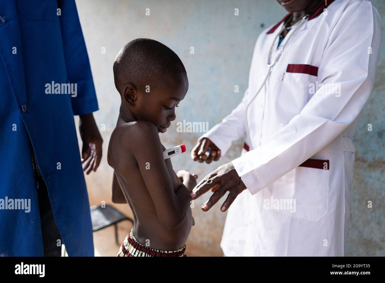 In diesem Bild überprüfen zwei medizinische Fachkräfte den Gesundheitszustand eines sehr mageren schwarzen Jungen, der sich einer Vorschuluntersuchung unterziehen muss, unter anderem Stockfoto