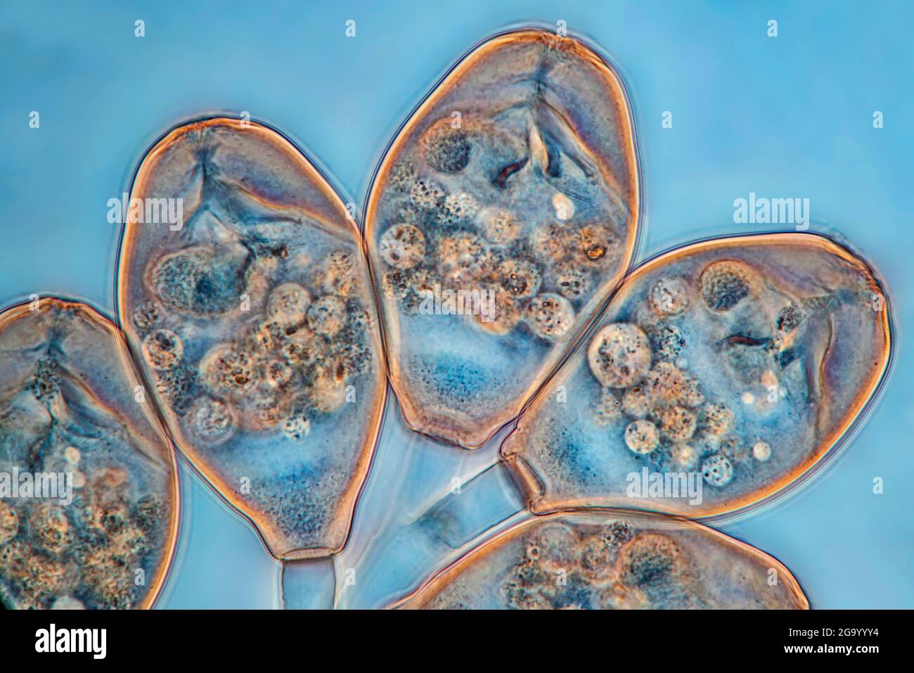 Vorticella (Vorticella spec.), Phasenkontrast-MRT-Bild, Vergrößerung x57 bezogen auf einen Druck mit 10 cm Breite Stockfoto