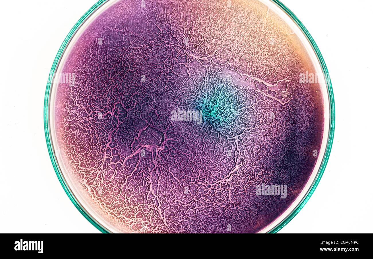 Die Oberfläche von biologischem Gewebe, das mit pathogenen Mikroorganismen infiziert ist Stockfoto