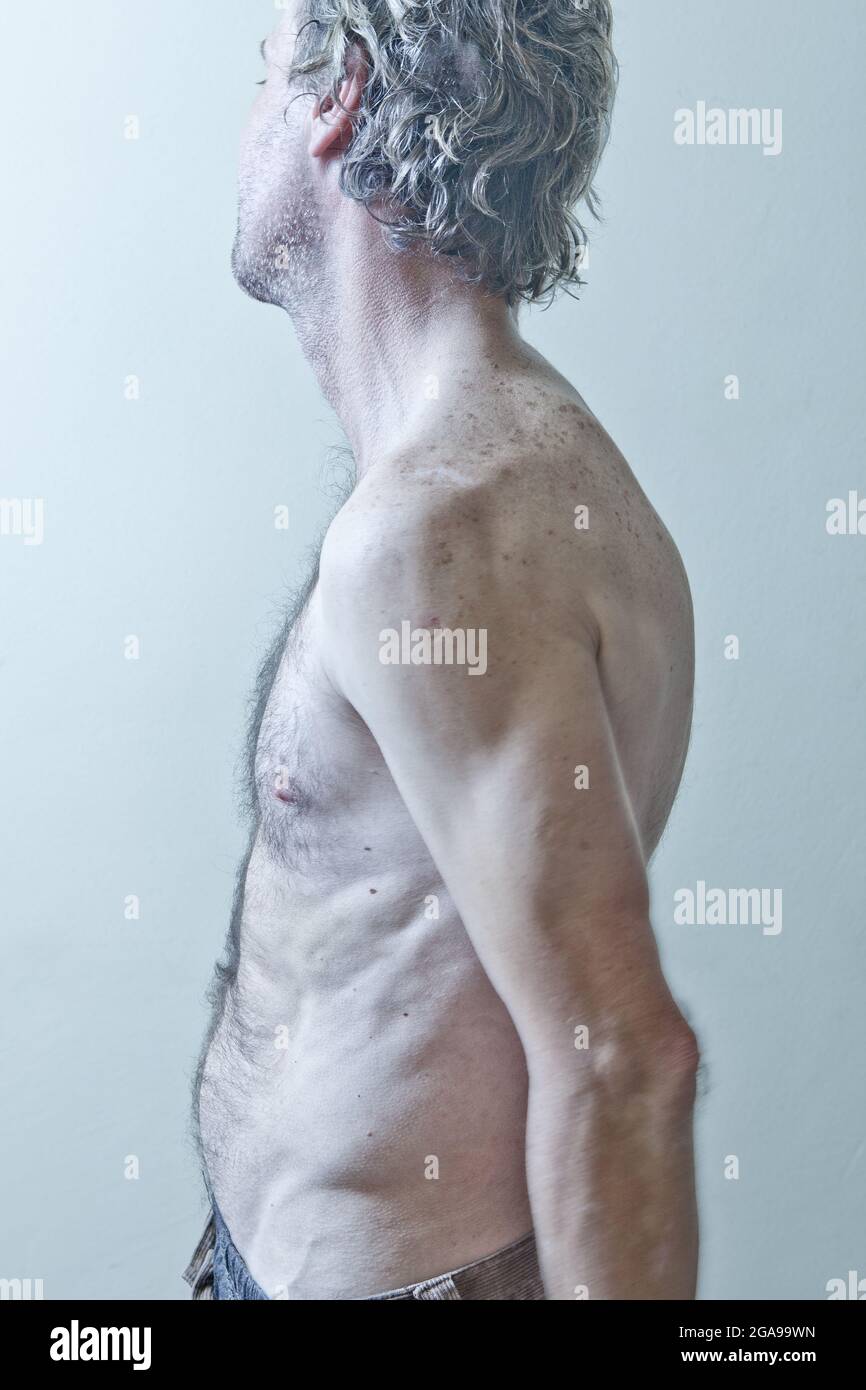Brust- und Sommersprossen-Haut eines muskulösen weißhaarigen Mannes. Starke Muskeln des Oberkörpers. Nahaufnahme von Sommersprossen auf der Haut. Stockfoto