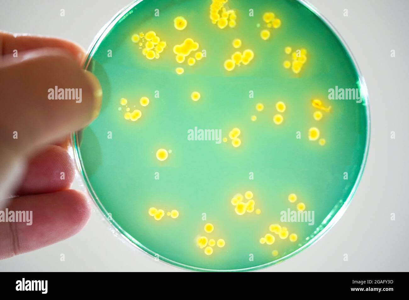 TCBS-Agar-Platte, leichte Mikrografie Stockfoto