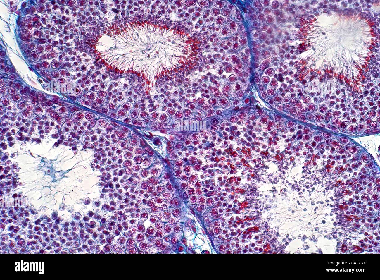 Humaner Hoden, leichte Mikrograph Stockfoto