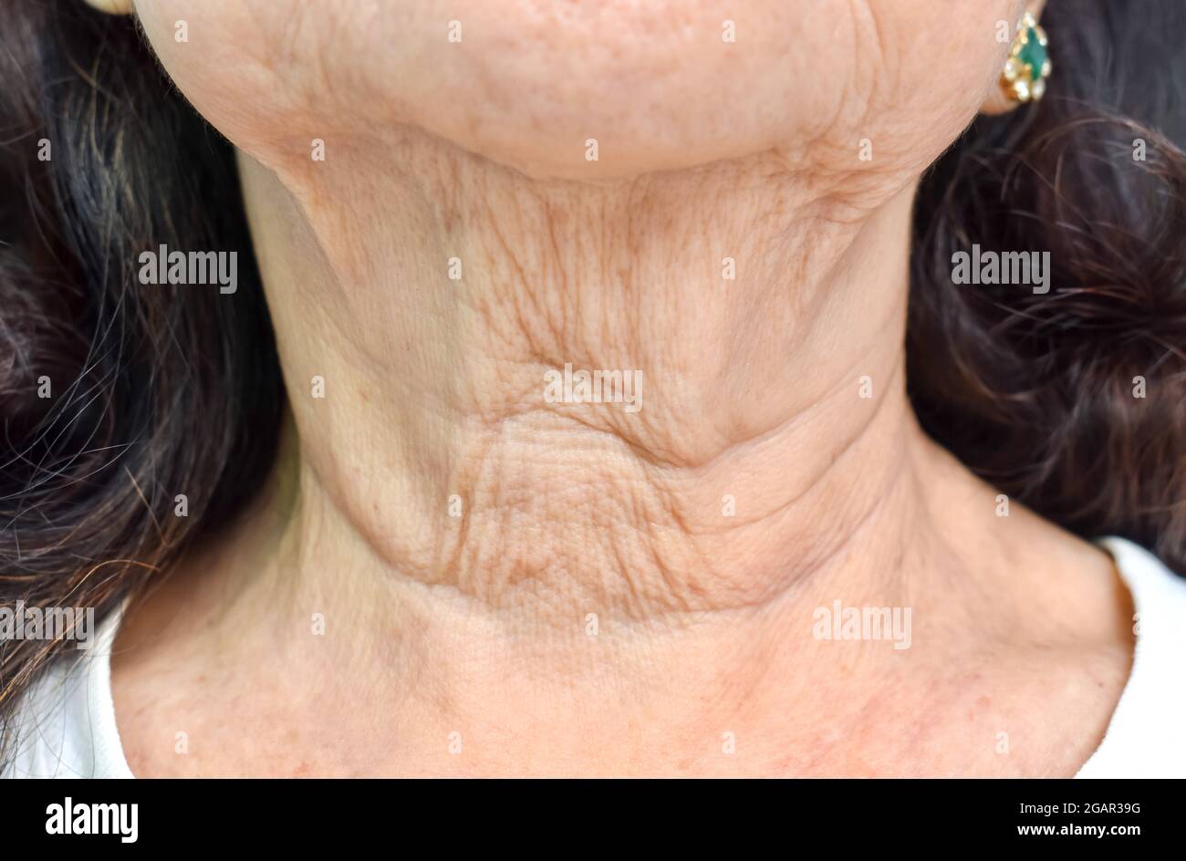 Alternde Hautfalten oder Hautfalten oder Falten am Hals südostasiatischer, älterer chinesischer Frau. Vorderansicht. Stockfoto