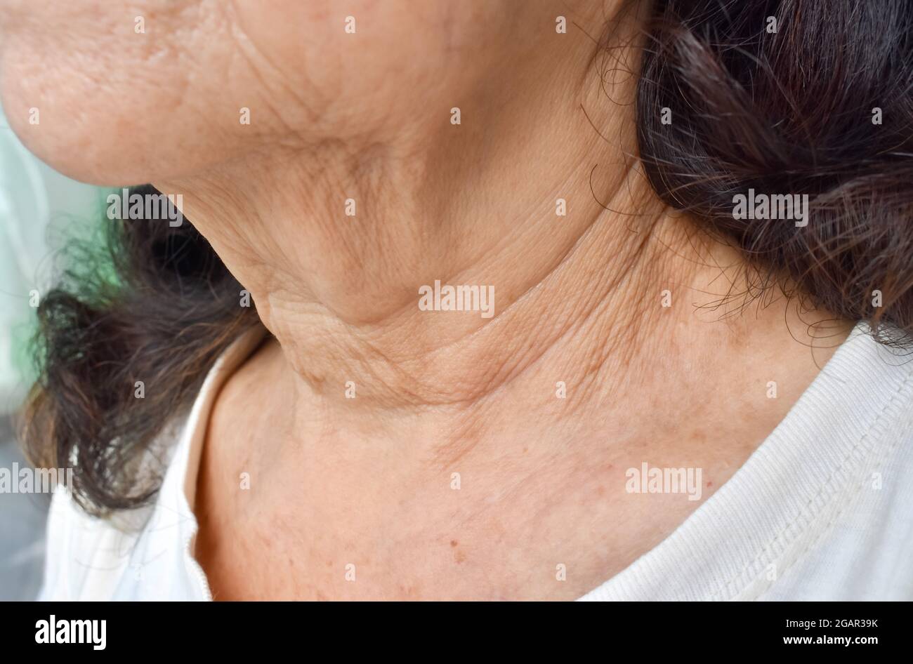 Alternde Hautfalten oder Hautfalten oder Falten am Hals südostasiatischer, älterer chinesischer Frau. Stockfoto
