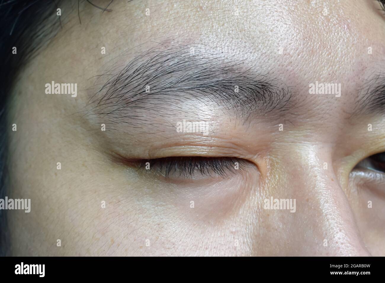 Alternde Hautfalten oder Hautfalten oder Falten im Gesicht, insbesondere das obere Augenlid des südostasiatischen, chinesischen jungen Mannes mit einem einzigen Augenlid. Frühe Alterung. Stockfoto
