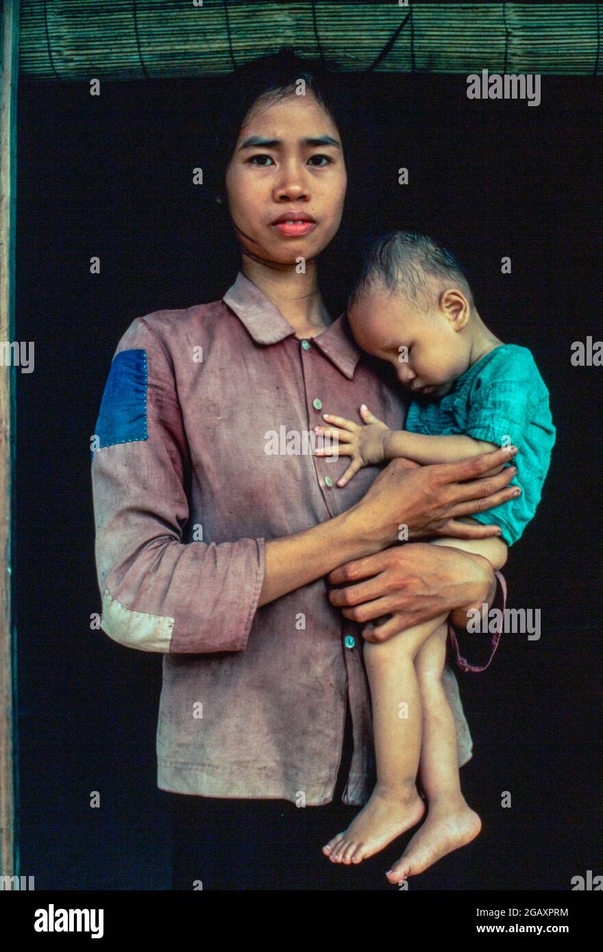 Pham Thi Huan, 24, mit ihrem ersten Kind, Bui Van Xuan, ist 20 Monate alt. Er kann weder sprechen, noch aufstehen und hat keine Augen. Sein Vater, Bui Van Tram, 28, ein Kriegsveteran, wurde dreimal mit Agent Orange besprüht. Juni 1980 Stockfoto