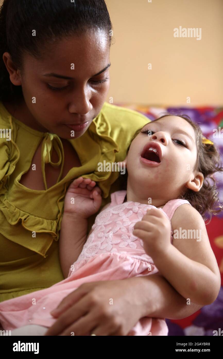 salvador, bahia, brasilien - 27. september 2017: Mutter saugt ihre Tochter während der Schwangerschaft in der Stadt Salvado mit Mikrozephalie, die durch das zica-Virus verursacht wird Stockfoto