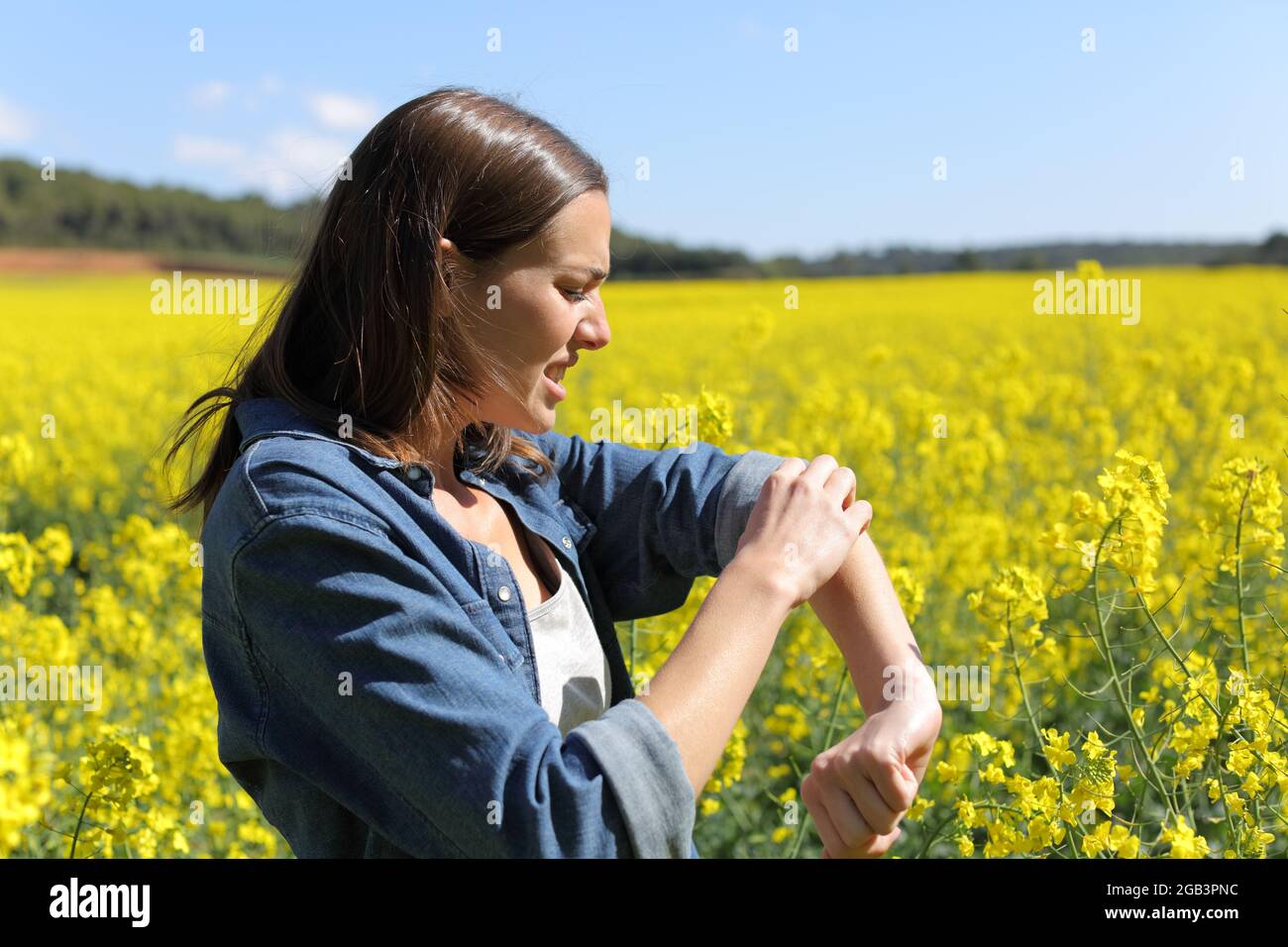 Gestresste Frau kratzt Arm in einem Feld im Sommer Stockfoto