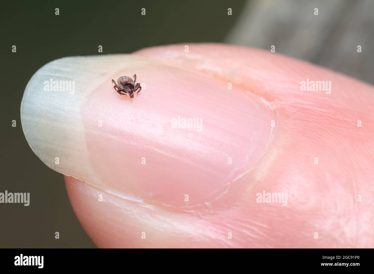 Makro EINER Tick auf den Finger Nagel EINER menschlichen Hand, um Größe zu zeigen, Hampshire UK Stockfoto