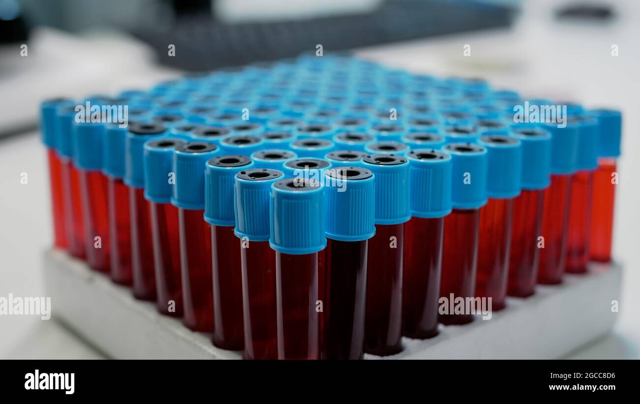 Nahaufnahme von medizinischen Staubsaugern mit Blut auf dem Tablett im Wissenschaftslabor. Laborglas mit roter Lösung auf dem Schreibtisch, bereit für die Analyse chemischer Experimente. Transparente Flaschen mit Substanz Stockfoto