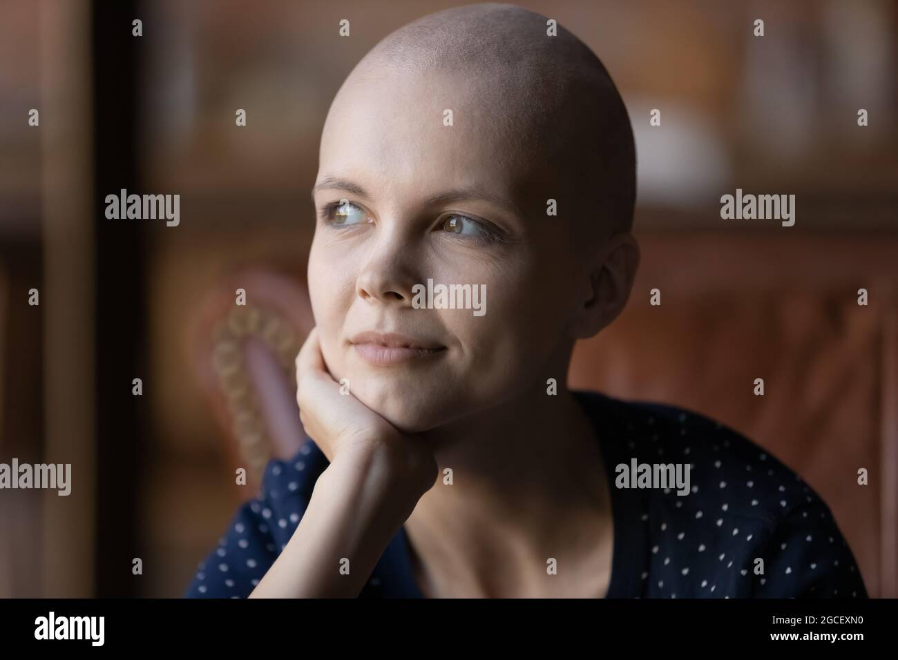 Positive nachdenkliche junge haarlose Frau mit Krebsporträt Stockfoto