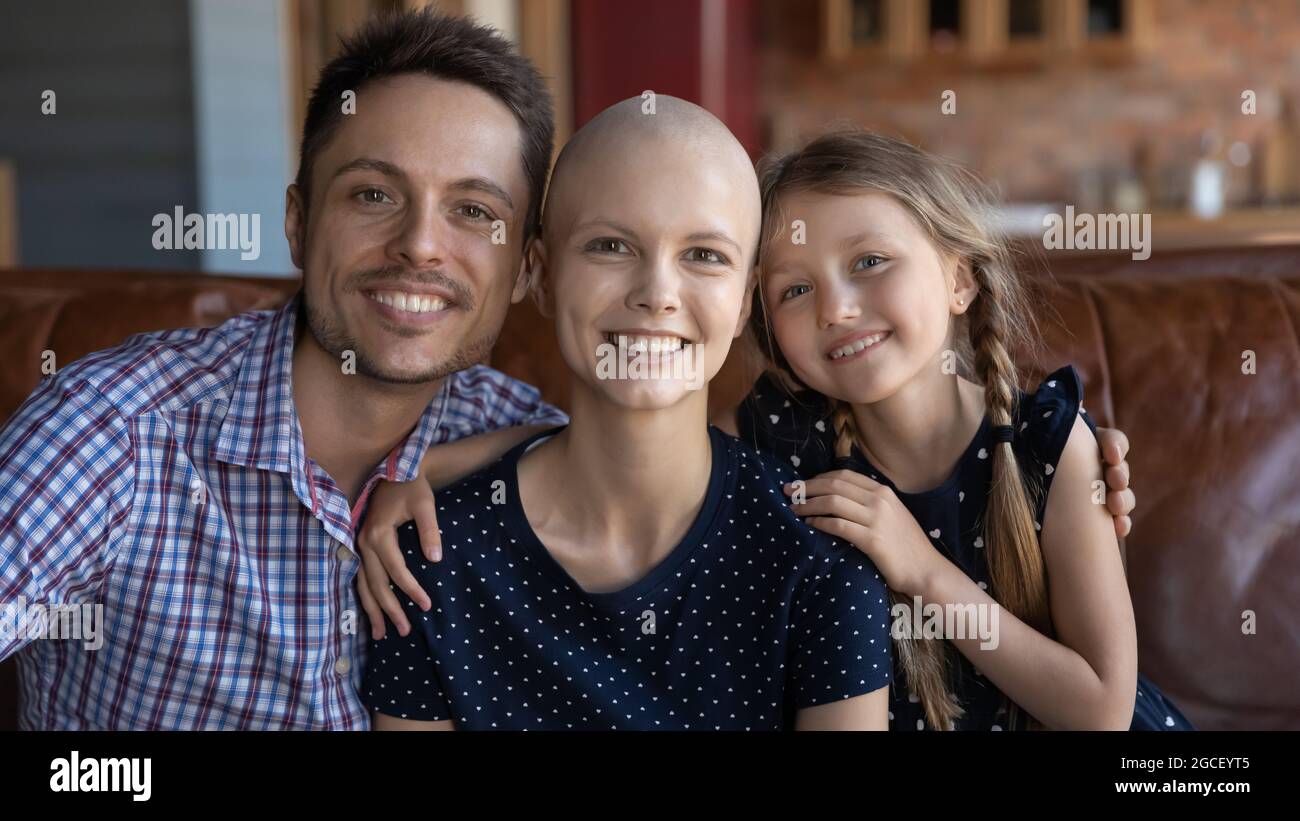 Glückliche optimistische haarlose junge Frau mit Krebs Stockfoto