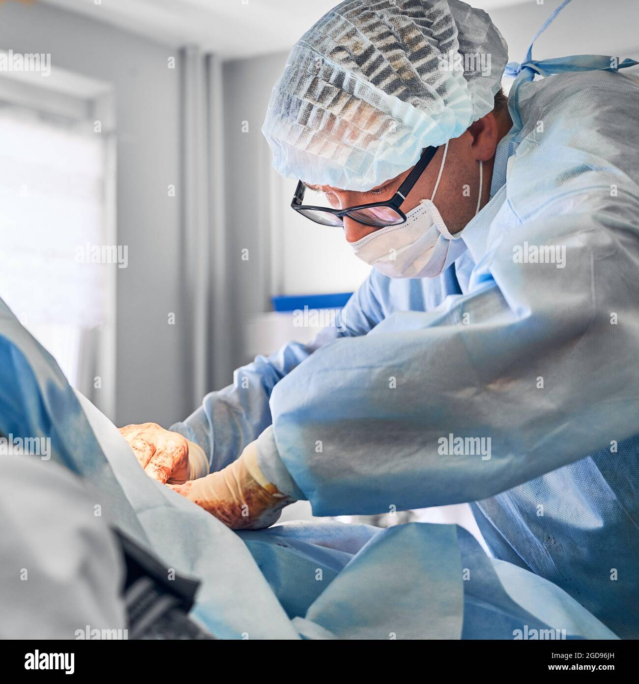 Männlicher plastischer Chirurg in einer Brille, die eine Bauchstraffung oder eine Bauchdeckenoperation im Operationssaal durchführt. Mann Arzt trägt chirurgische Uniform und medizinische Gesichtsmaske, während dabei abdominale plastische Chirurgie. Stockfoto