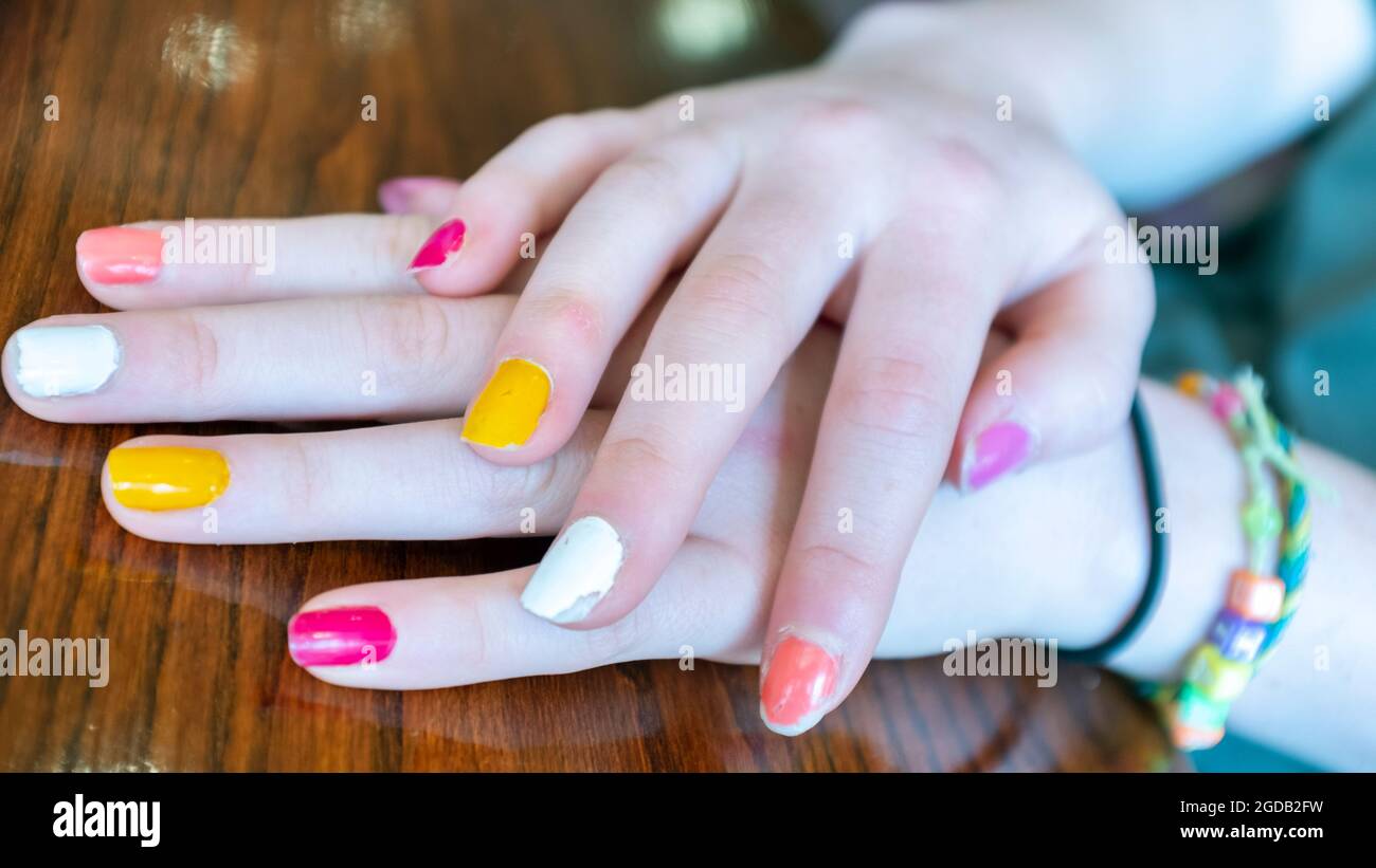 Ein junger Erwachsener Hände mit mehreren farbigen Nägeln. Stockfoto