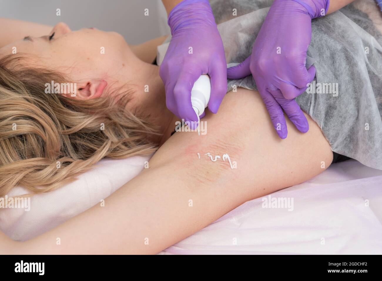 Kosmetisches Verfahren nach Enthaarung Creme auf die Achselhöhle auftragen. Epilation Reibecreme Hautmilderung im Spa-Salon Stockfoto
