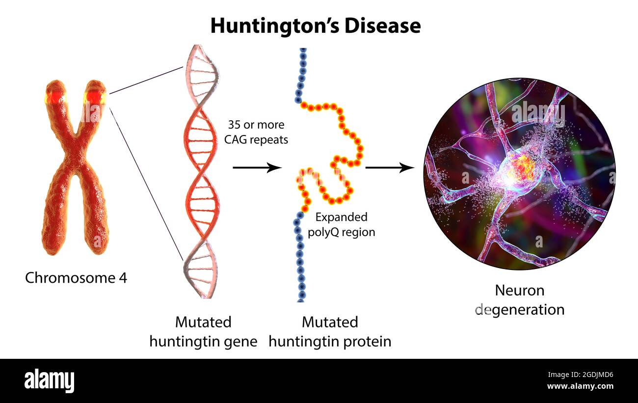Molekulare Genese der Huntington-Krankheit, 3D-Illustration Stockfoto