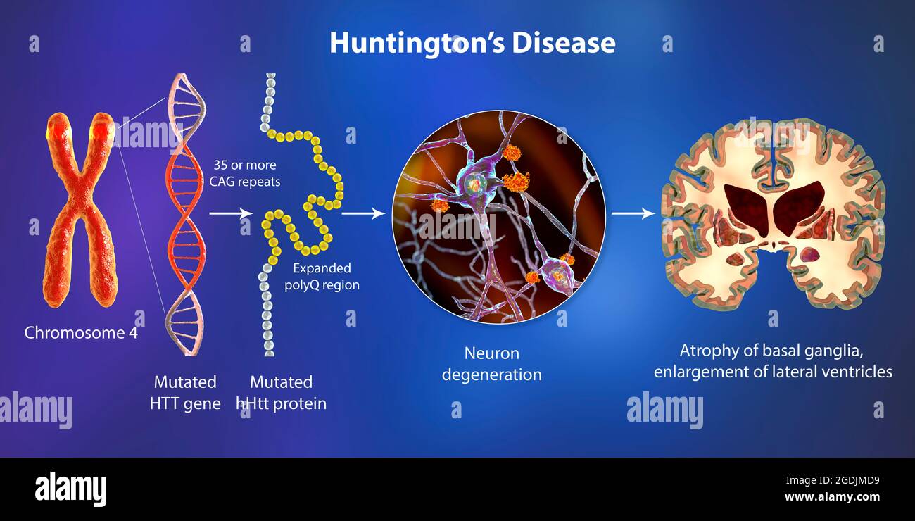Molekulare Genese der HuntingtonKrankheit, 3DIllustration