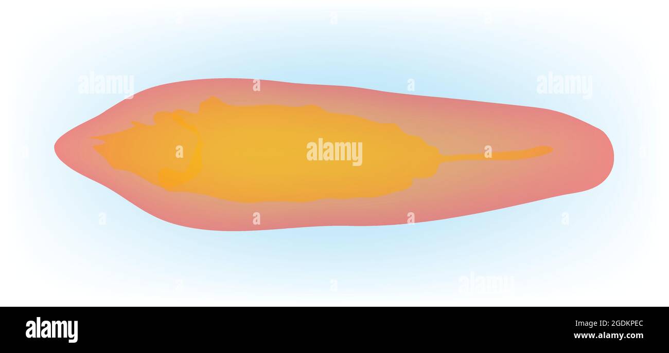 fasciola Anatomie, Fasciola hepatica, Egel Alamy